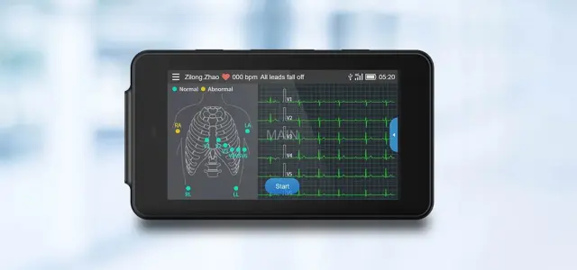 Pocket ECG